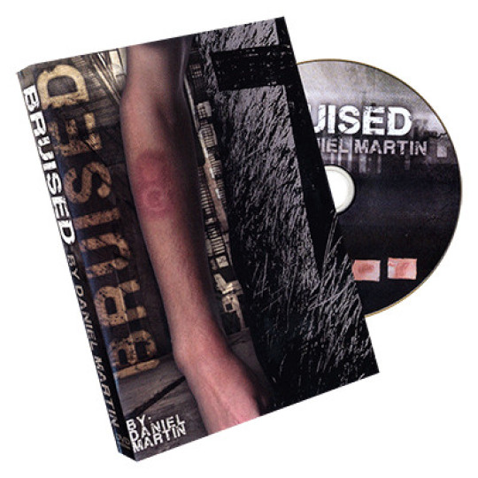 Bruised by Daniel Martin