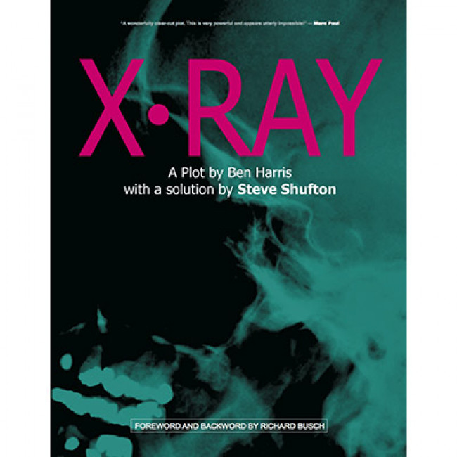 X-Ray by Ben Harris and Steve Shufton - Buch